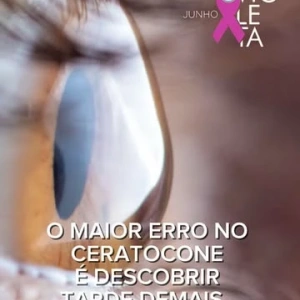 Você troca os óculos. Depois troca novamente. E, mesmo assim, continua sentindo que a visão não está tão boa quanto deveria.  Muitas pessoas acreditam que isso significa apenas aumento do grau. Mas existe um detalhe importante que pouca gente conhece. Em alguns casos, mudanças frequentes no grau podem ser um dos primeiros sinais do ceratocone.  E o problema é que essa doença costuma evoluir de forma silenciosa.  Sem dor. Sem vermelhidão. Sem sintomas que chamem muita atenção no início. Por isso, é comum que o diagnóstico aconteça apenas quando as alterações da córnea já estão mais avançadas.  No Centro de Excelência em Oftalmologia, acompanhamos frequentemente pacientes que chegaram ao consultório acreditando que estavam apenas trocando de grau.  Mas, após uma investigação mais detalhada, descobrimos alterações compatíveis com ceratocone ainda em fases iniciais.  Foi exatamente por observar essa realidade ao longo dos anos que passamos a investir continuamente em tecnologia diagnóstica capaz de identificar alterações muito precoces da córnea.  Hoje dispomos de exames modernos que permitem uma avaliação extremamente detalhada, muitas vezes antes mesmo que os sintomas se tornem mais evidentes.  E quanto antes o ceratocone é diagnosticado, maiores costumam ser as possibilidades de acompanhar sua evolução e indicar o tratamento mais adequado para cada situação.  Se você percebe mudanças frequentes no grau. Se os óculos nunca parecem proporcionar a qualidade visual que você espera.  Ou se existe histórico de ceratocone na sua família. Talvez seja o momento de investigar mais profundamente.  Escreva CERATOCONE nos comentários que eu envio mais informações.  Dra. Silvia Maia Médica Oftalmologista CRM-MG 66953 | RQE 55690 Centro de Excelência em Oftalmologia