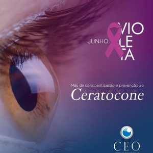 💜 Junho Violeta: mês de conscientização e prevenção ao Ceratocone.  O ceratocone é uma doença ocular que provoca o afinamento e a deformação da córnea, fazendo com que ela adquira um formato semelhante a um cone. Essa alteração pode causar visão embaçada, distorcida, sensibilidade à luz e dificuldade para enxergar com nitidez.  🔍 O diagnóstico precoce é fundamental para acompanhar a evolução da doença e indicar o tratamento mais adequado, evitando a progressão e preservando a qualidade da visão.  No CEO – Centro de Excelência em Oftalmologia, contamos com especialistas em ceratocone, preparados para realizar a avaliação completa, o diagnóstico e o acompanhamento individualizado de cada paciente.  ⚠️ Durante todo o mês de junho, acompanhe nossas redes sociais. Vamos compartilhar informações, orientações e dicas importantes para ajudar você a entender melhor o ceratocone, identificar sinais de alerta e cuidar da sua saúde ocular.  👁️ Cuidar da visão é investir em qualidade de vida.