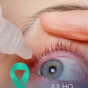 Nem todo colírio é a solução.   Você usa qualquer colírio sempre que sente desconforto nos olhos?  Essa prática pode mascarar sintomas e atrasar o diagnóstico. E tem um detalhe que quase ninguém sabe: existem diferentes tipos de olho seco — e cada um exige um tratamento específico.  O colírio que funciona para uma pessoa pode não resolver nada no seu caso. Por isso, somente uma avaliação oftalmológica completa consegue identificar a causa real do problema e indicar o tratamento ideal para você.  Neste Julho Turquesa, fica o alerta: automedicação não substitui uma consulta.   Quer saber como está a saúde dos seus olhos? Comente OLHO SECO aqui embaixo.   Dr. Jonatas Diniz da Silva CRM-MG 106617 | RQE 65385 Centro de Excelência em Oftalmologia - Hospital Dia