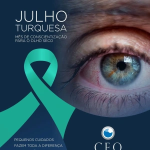 💙 Julho Turquesa é o mês de conscientização sobre a Síndrome do Olho Seco, uma condição que afeta milhões de pessoas e pode comprometer significativamente a qualidade de vida quando não é tratada.  Você sente: 👁️ Ardência ou queimação? 👁️ Sensação de areia nos olhos? 👁️ Vermelhidão, lacrimejamento excessivo ou visão embaçada?  Esses podem ser sinais de olho seco e merecem atenção.  Pequenos cuidados, como manter a hidratação, evitar exposição prolongada às telas sem pausas e realizar uma avaliação oftalmológica regularmente, fazem toda a diferença para preservar a saúde dos seus olhos.  No CEO – Centro de Excelência em Oftalmologia, contamos com equipe especializada e tecnologia para diagnosticar e indicar o tratamento mais adequado para cada caso.  💙 Neste Julho Turquesa, cuide da sua visão. Seus olhos agradecem!
