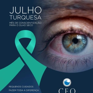 💙 Julho Turquesa é o mês de conscientização sobre a Síndrome do Olho Seco, uma condição que afeta milhões de pessoas e pode comprometer significativamente a qualidade de vida quando não é tratada.  Você sente: 👁️ Ardência ou queimação? 👁️ Sensação de areia nos olhos? 👁️ Vermelhidão, lacrimejamento excessivo ou visão embaçada?  Esses podem ser sinais de olho seco e merecem atenção.  Pequenos cuidados, como manter a hidratação, evitar exposição prolongada às telas sem pausas e realizar uma avaliação oftalmológica regularmente, fazem toda a diferença para preservar a saúde dos seus olhos.  No CEO – Centro de Excelência em Oftalmologia, contamos com equipe especializada e tecnologia para diagnosticar e indicar o tratamento mais adequado para cada caso.  💙 Neste Julho Turquesa, cuide da sua visão. Seus olhos agradecem!
