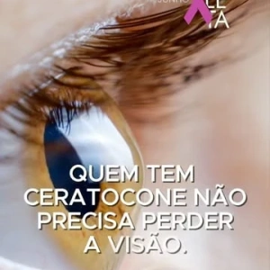 Você pode estar interpretando errado um sinal importante da sua visão.  Quando o grau muda com frequência, quando os óculos parecem bons por pouco tempo ou quando a visão continua meio insatisfatória mesmo depois da troca, muita gente pensa que isso é apenas uma mudança normal do grau.  Mas nem sempre é.  Em alguns casos, esses sinais podem indicar o início de um ceratocone. Uma alteração da córnea que costuma evoluir de forma silenciosa e que, no começo, pode ser facilmente confundida com algo simples.  E é justamente aí que mora o problema.  Porque enquanto você acredita que está apenas trocando os óculos mais uma vez, a córnea pode continuar sofrendo alterações sem que isso seja percebido. E quando o diagnóstico acontece tarde, o impacto na qualidade visual pode já ser maior do que deveria.  A boa notícia é que hoje já existem exames extremamente precisos, capazes de identificar alterações muito precoces da córnea. Muitas vezes antes mesmo que os sintomas se tornem mais evidentes. E quanto antes o ceratocone é identificado, maiores costumam ser as possibilidades de acompanhar sua evolução de forma adequada e indicar o tratamento mais apropriado para cada caso.  No Centro de Excelência em Oftalmologia, acompanhamos com frequência pacientes que gostariam de ter investigado a córnea mais cedo. Pacientes que passaram por trocas repetidas de óculos, perceberam a visão piorando aos poucos e só depois descobriram que o problema não era apenas o grau. É exatamente por observar essa realidade tão de perto que damos tanta importância ao diagnóstico precoce.  Se o seu grau muda frequentemente, se os óculos nunca parecem totalmente satisfatórios ou se existe histórico de ceratocone na sua família, talvez seja o momento de fazer uma avaliação mais detalhada.  Se você gostaria de saber mais sobre ceratocone e diagnóstico precoce, escreva CERATOCONE nos comentários.  Dra. Sílvia Maia Médica Oftalmologista CRM-MG 66953 | RQE 55690 Centro de Excelência em Oftalmologia