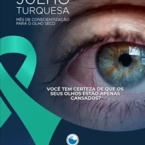 Você pode conviver com olho seco há meses... sem perceber que esse é o problema.  ⠀  Ardência.  Sensação de areia.  Olhos vermelhos.  Visão que embaça e melhora quando você pisca.  A necessidade de usar colírios várias vezes ao dia.  Muita gente acredita que isso é apenas cansaço, excesso de telas ou consequência da idade. Mas nem sempre é assim.  ⠀  A Síndrome do Olho Seco é uma doença que pode comprometer não apenas o conforto, mas também a qualidade da sua visão e da sua rotina.  Ler, dirigir, trabalhar no computador ou simplesmente aproveitar um momento de lazer pode se tornar cada vez mais desconfortável.  E o mais importante: quanto mais cedo o diagnóstico é feito, maiores são as chances de controlar a doença e preservar a saúde da superfície ocular.  ⠀  O tratamento não é igual para todos.  Antes de indicar qualquer abordagem, é fundamental descobrir a verdadeira causa do problema.  Produção reduzida da lágrima, evaporação excessiva, alterações das glândulas das pálpebras ou outros fatores exigem tratamentos diferentes.  Por isso, uma avaliação especializada faz toda a diferença.  ⠀  No Centro de Excelência em Oftalmologia, utilizamos tecnologia específica para investigar a origem do olho seco e definir um tratamento individualizado, baseado nas necessidades de cada paciente.  Meu objetivo não é apenas aliviar os sintomas temporariamente, mas tratar a causa do problema sempre que possível.  ⠀  Neste Julho Turquesa, aproveite para dar mais atenção à saúde dos seus olhos.  Pequenos sintomas podem ser o primeiro sinal de uma condição que merece tratamento.  ⠀  Se você sente algum desses sintomas ou quer saber se pode ter Síndrome do Olho Seco, comente OLHO SECO aqui embaixo.  Dr. Jonatas Diniz da Silva CRM-MG 106617 | RQE 65385