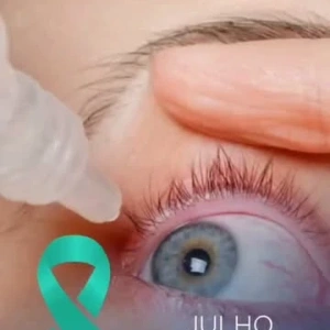 Nem todo colírio é a solução.   Você usa qualquer colírio sempre que sente desconforto nos olhos?  Essa prática pode mascarar sintomas e atrasar o diagnóstico. E tem um detalhe que quase ninguém sabe: existem diferentes tipos de olho seco — e cada um exige um tratamento específico.  O colírio que funciona para uma pessoa pode não resolver nada no seu caso. Por isso, somente uma avaliação oftalmológica completa consegue identificar a causa real do problema e indicar o tratamento ideal para você.  Neste Julho Turquesa, fica o alerta: automedicação não substitui uma consulta.   Quer saber como está a saúde dos seus olhos? Comente OLHO SECO aqui embaixo.   Dr. Jonatas Diniz da Silva CRM-MG 106617 | RQE 65385 Centro de Excelência em Oftalmologia - Hospital Dia